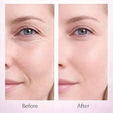 Natural Gentle 5% Volufiline PDRN Collagen Stick Multi Functional Hydrating Plumping Balm For Daily Full Body Skin Maintenance